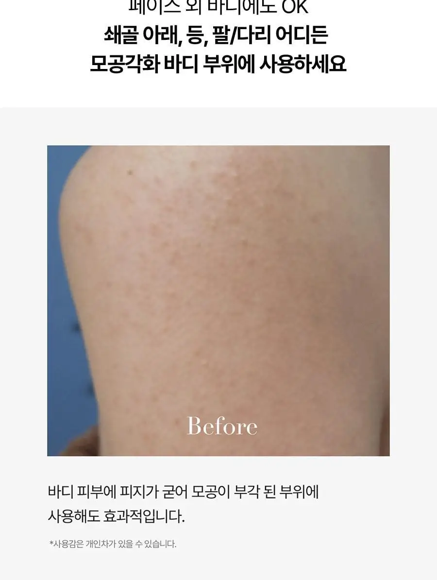 [피지클리너] 메디필 엑스트라 슈퍼9 플러스 2.0 250ml 기획 상세페이지 49